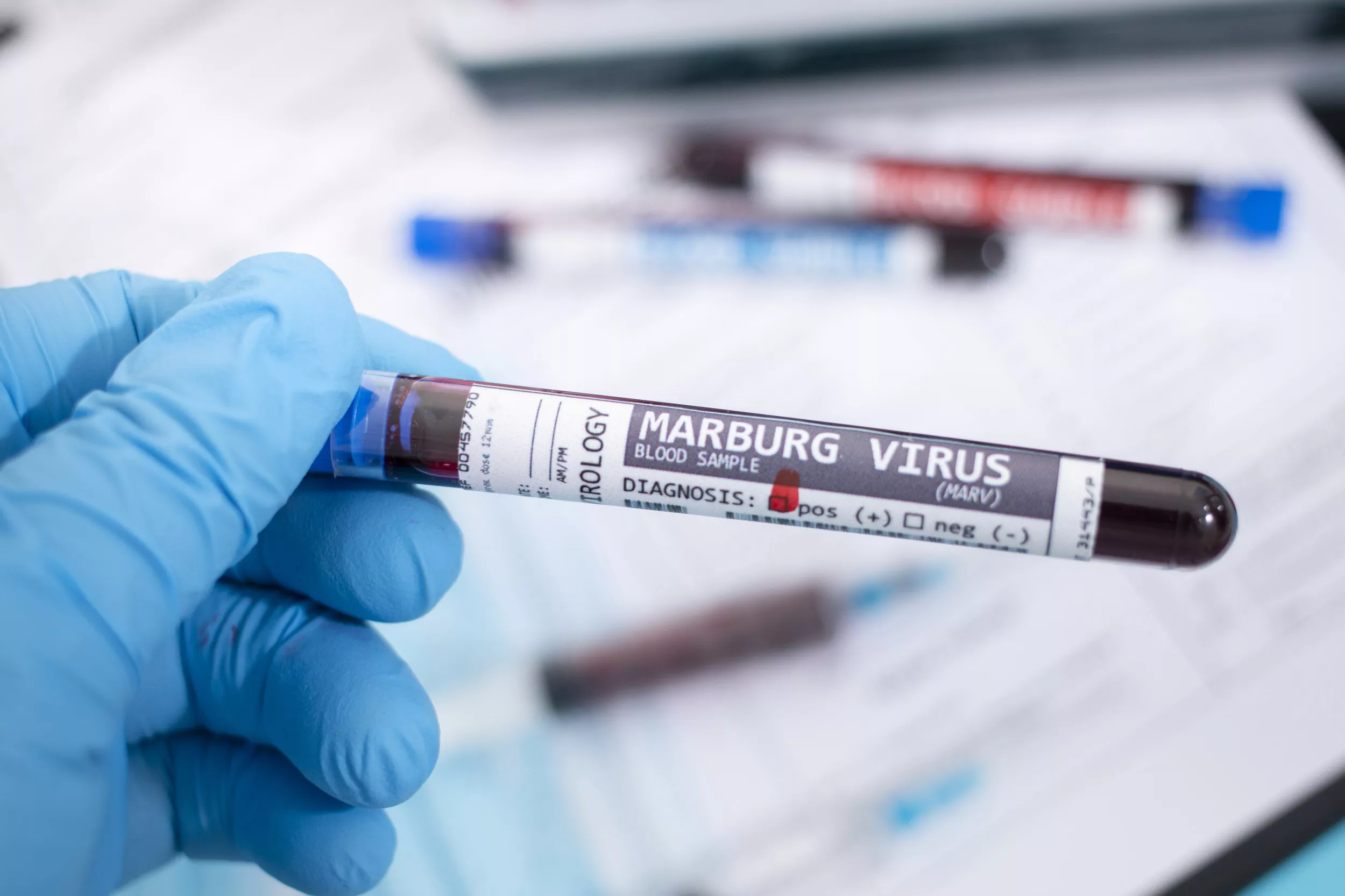 Marburg Virus Outbreak: Tanzania Announces Spread of Deadly Disease - Vimarsana News