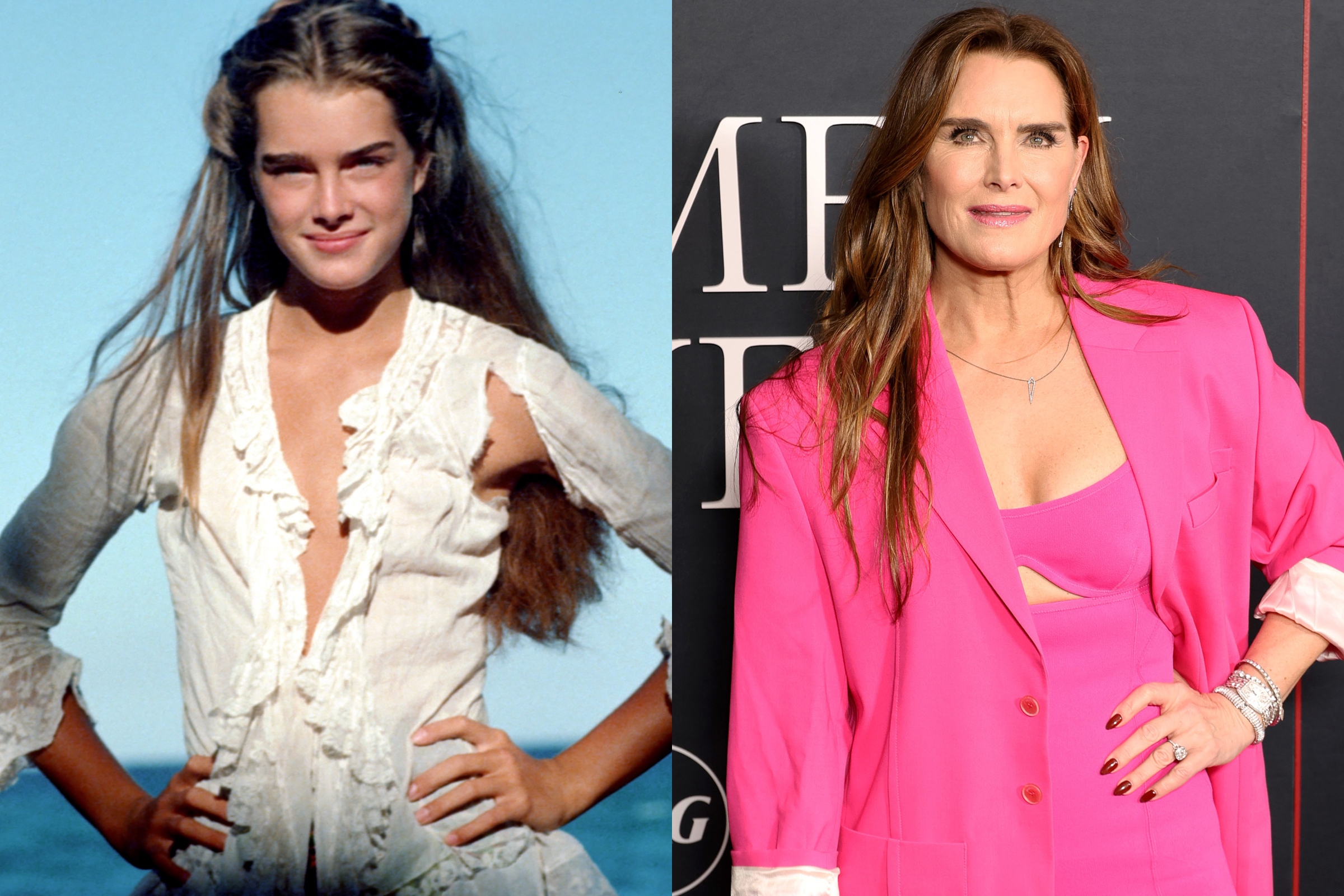 Brooke Shields Sexualization as a Child Was Staggering photo