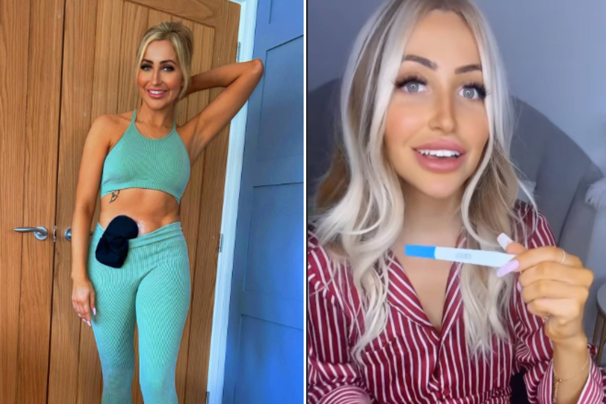Life after colon cancer and a barbie butt surgery with an ostomy! #ca... |  TikTok