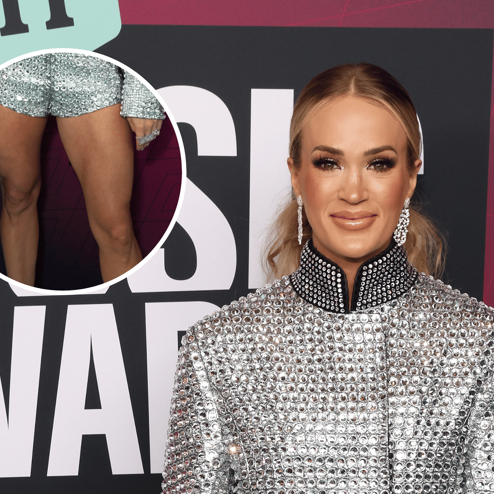 Carrie Underwood's Legs at CMT Music Awards Spark Debate