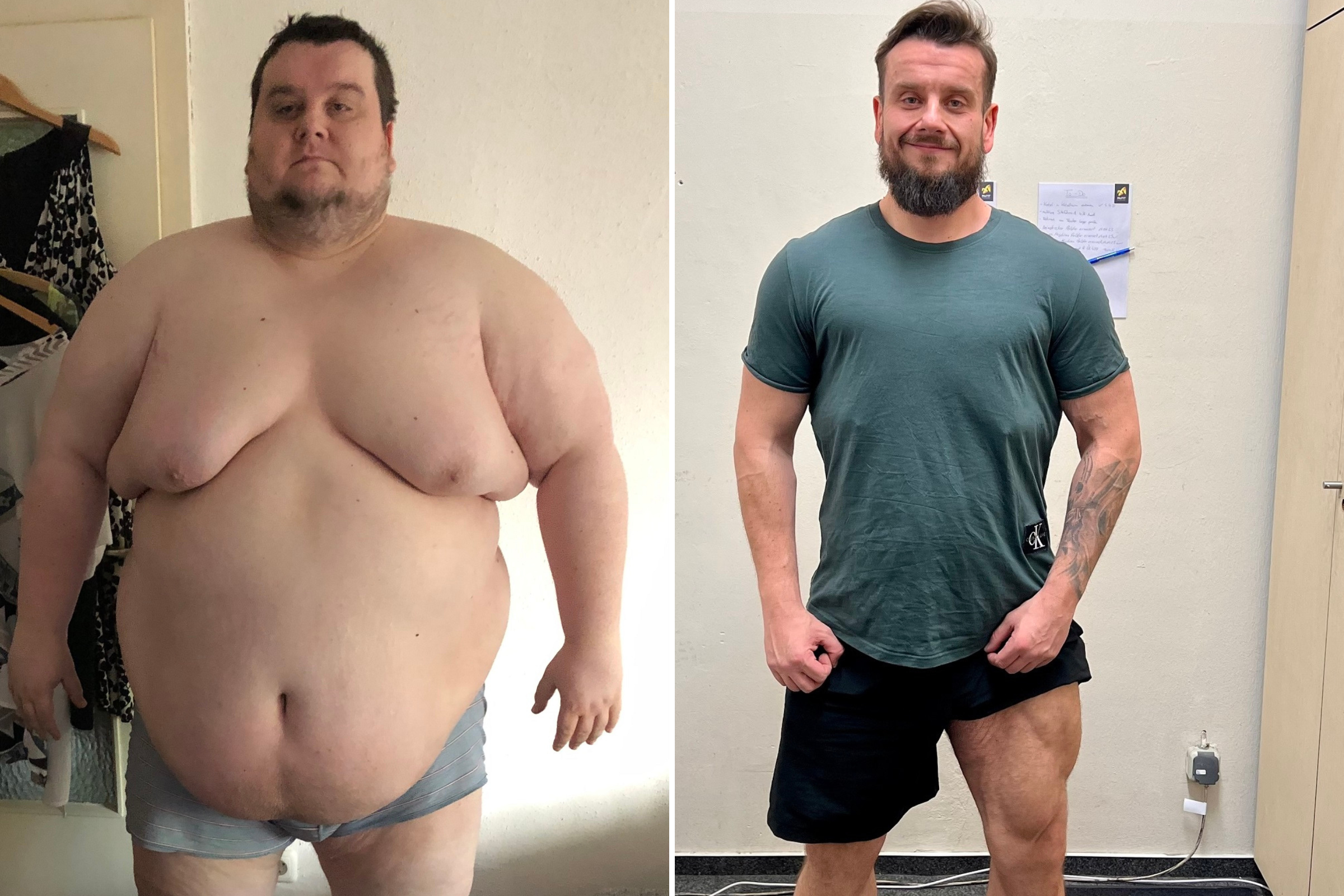 Weight-Loss Plans for a 300-Pound Man