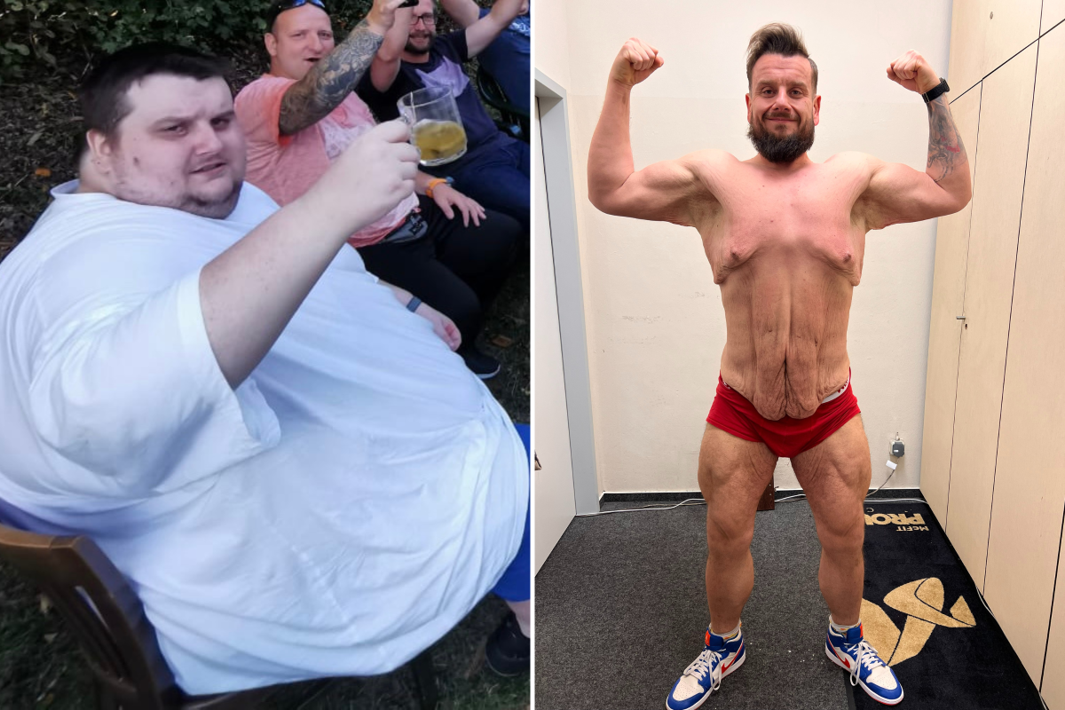 Michael Mehler showing his weight loss
