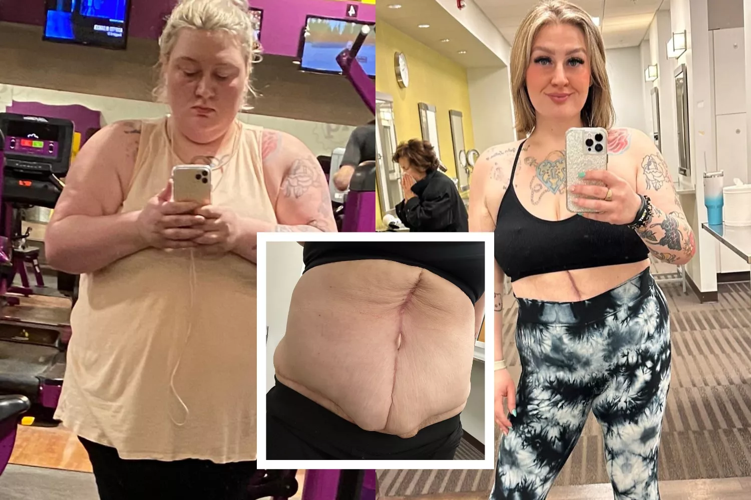 Woman, 28, who has saggy skin that makes her look DECADES older