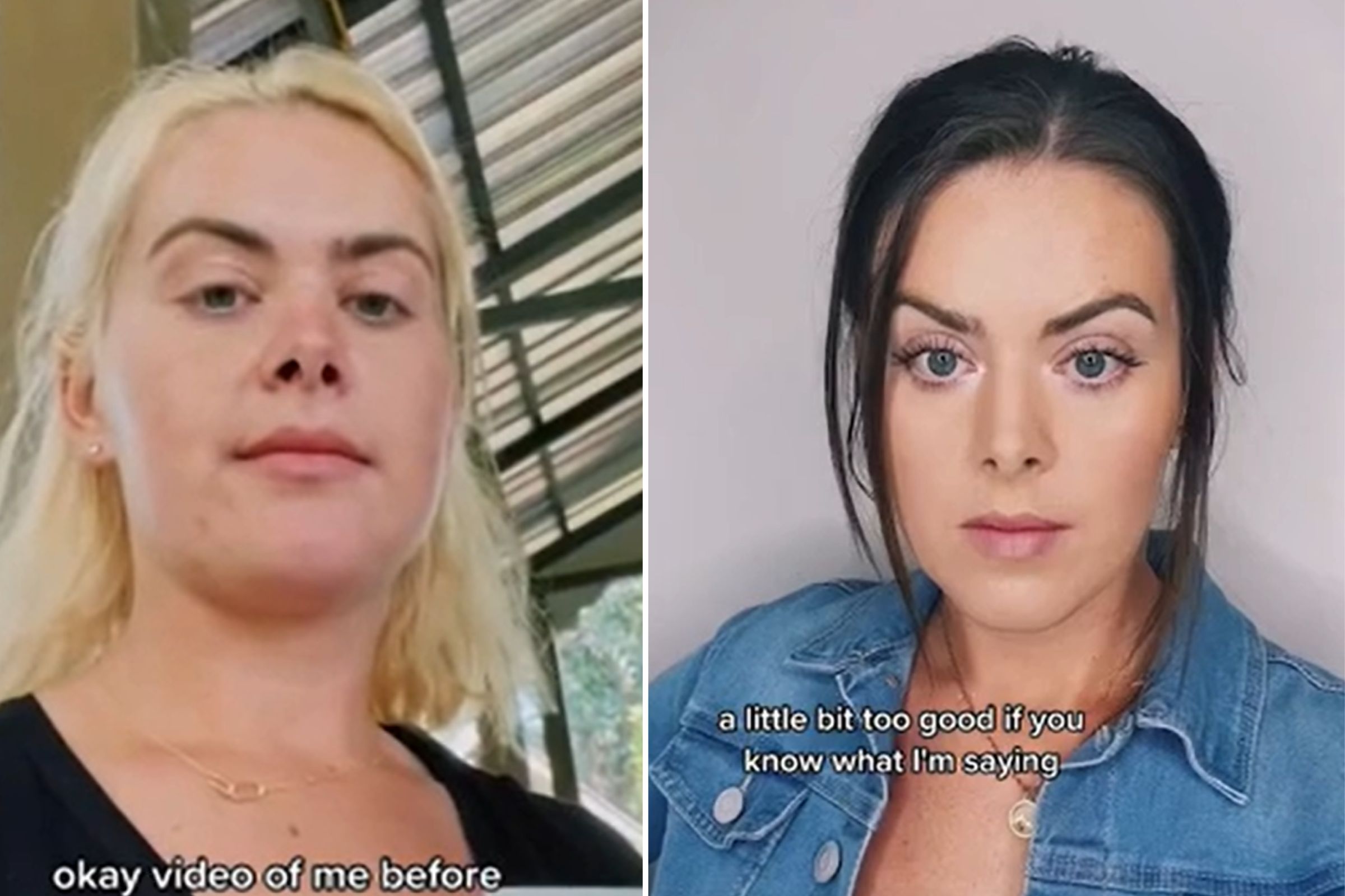 Woman Reveals How Her Puffy Face Disappeared In 4 Months Without 