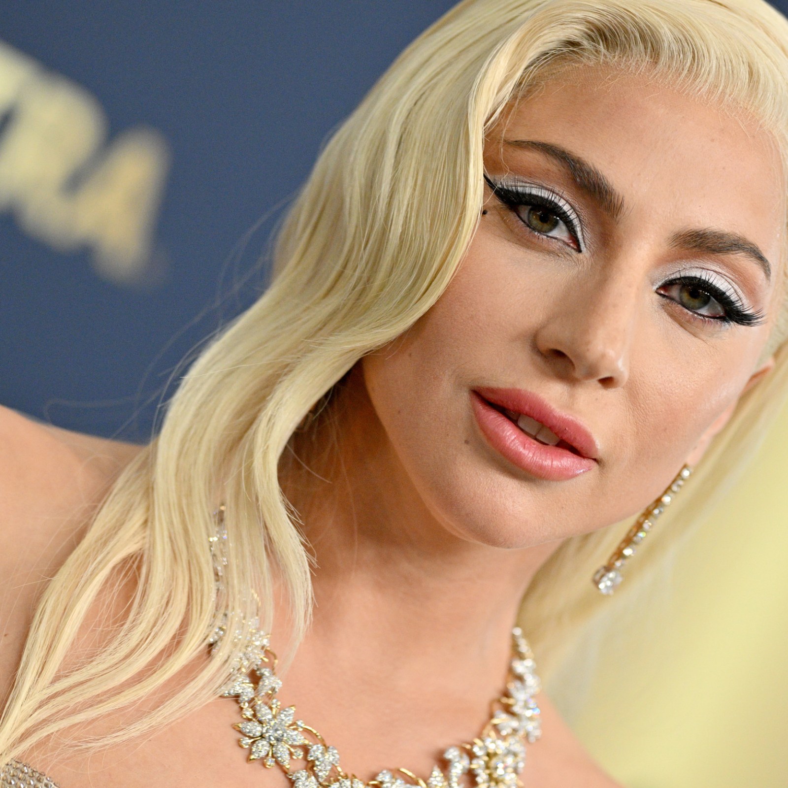 Lady Gaga Slammed For Appearing In Ad Campaign For Migraine Drug