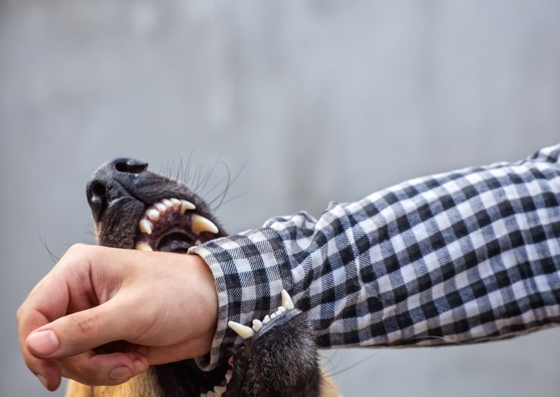 Dog biting human arm.