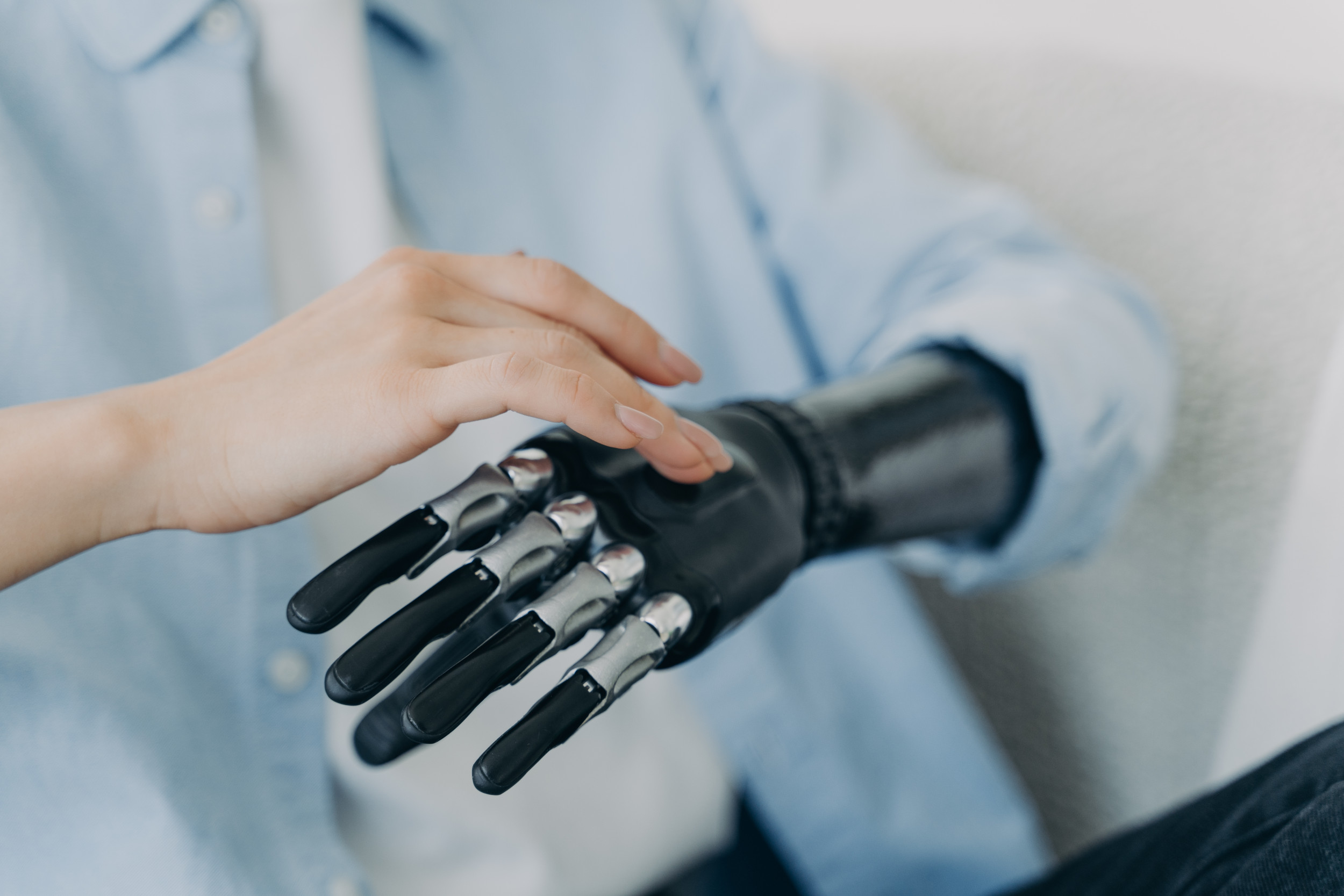 Man With Amputated Arm Gets Bionic Hand in Surgical Breakthrough - Newsweek