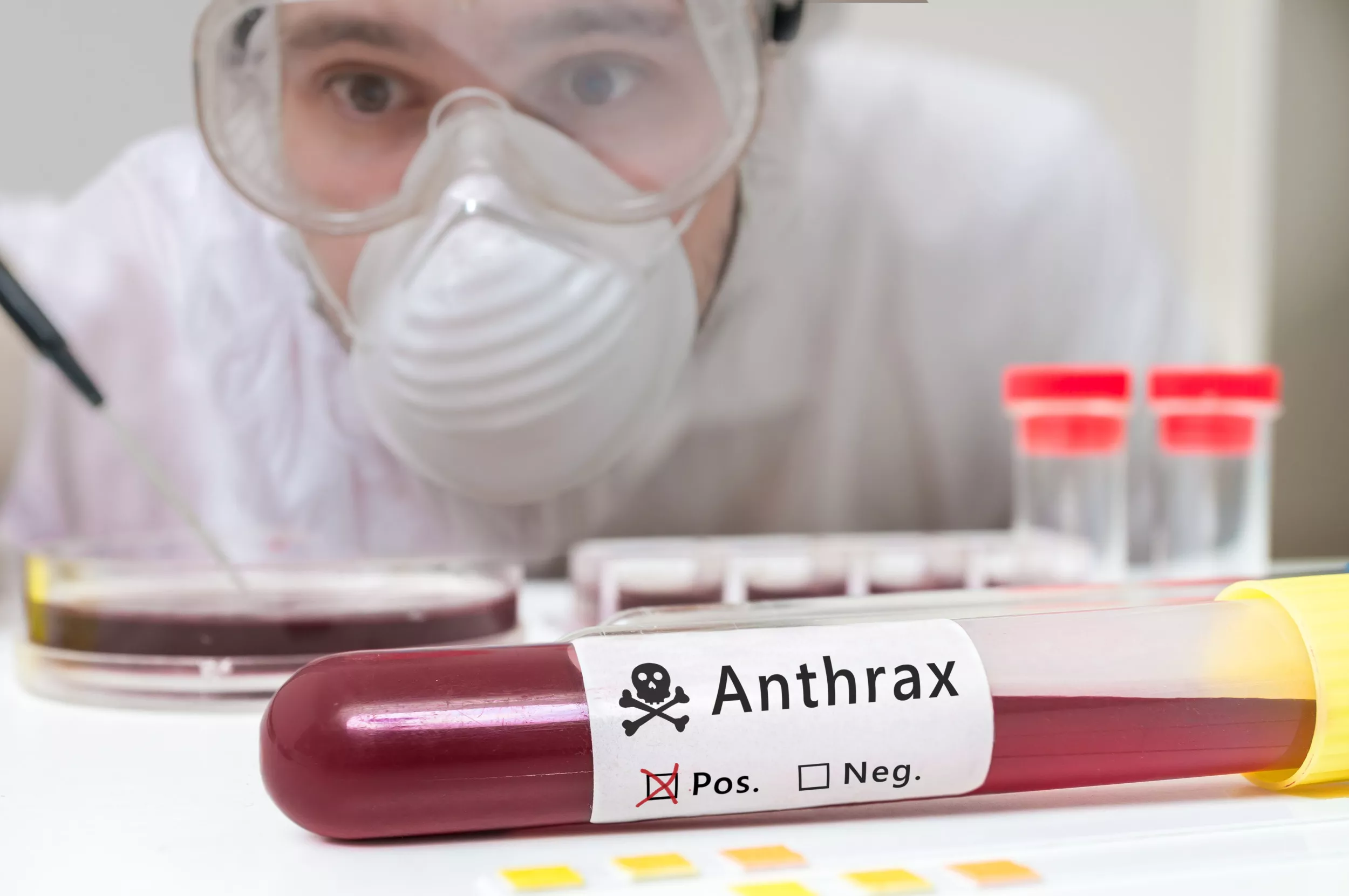 Anthrax-Infected Russians Escape Siberian Hospital - Vimarsana News
