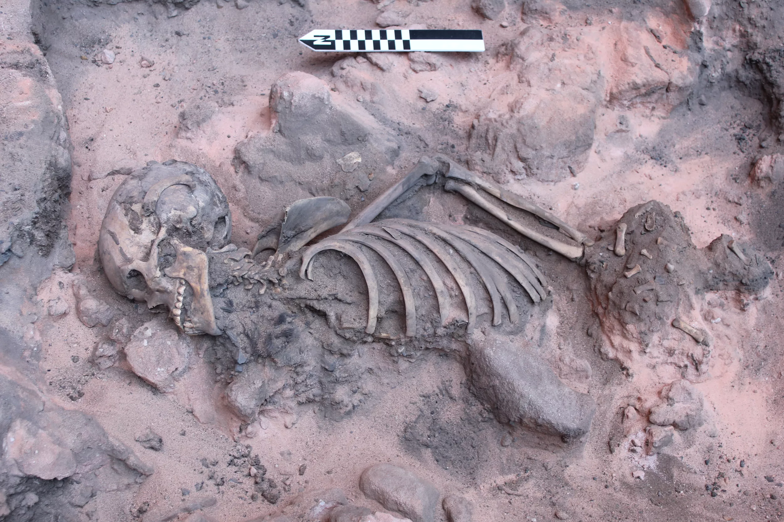 Skeleton of Disabled Teen With Bracelet Puzzles Archaeologists - Vimarsana News
