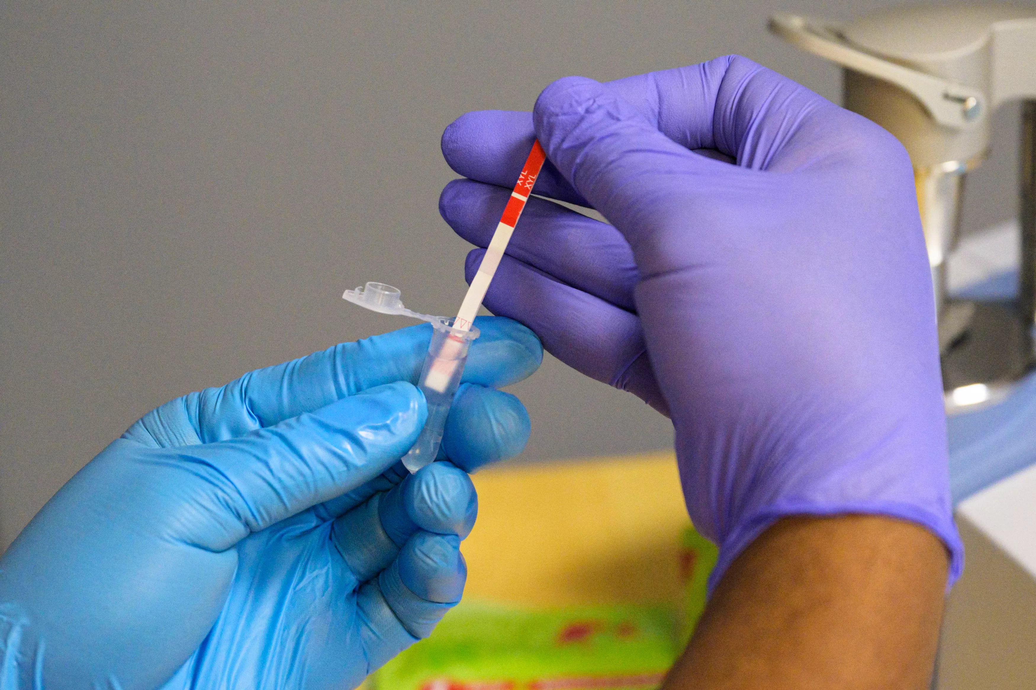 Gruesome Photos Reveal Horrors of 'Zombie' Drug Fentanyl Additive - Vimarsana News