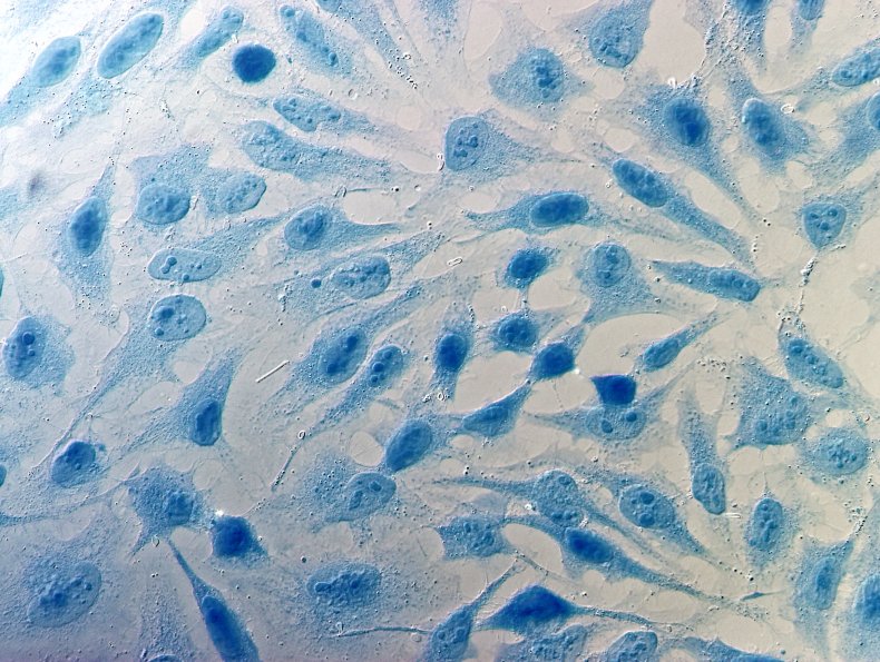 HeLa cells
