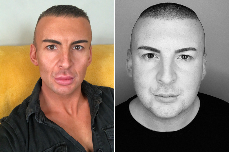 Man Who Ate 4,000 Calories In 2 Hours Is Unrecognizable After Losing 110lbs(09)