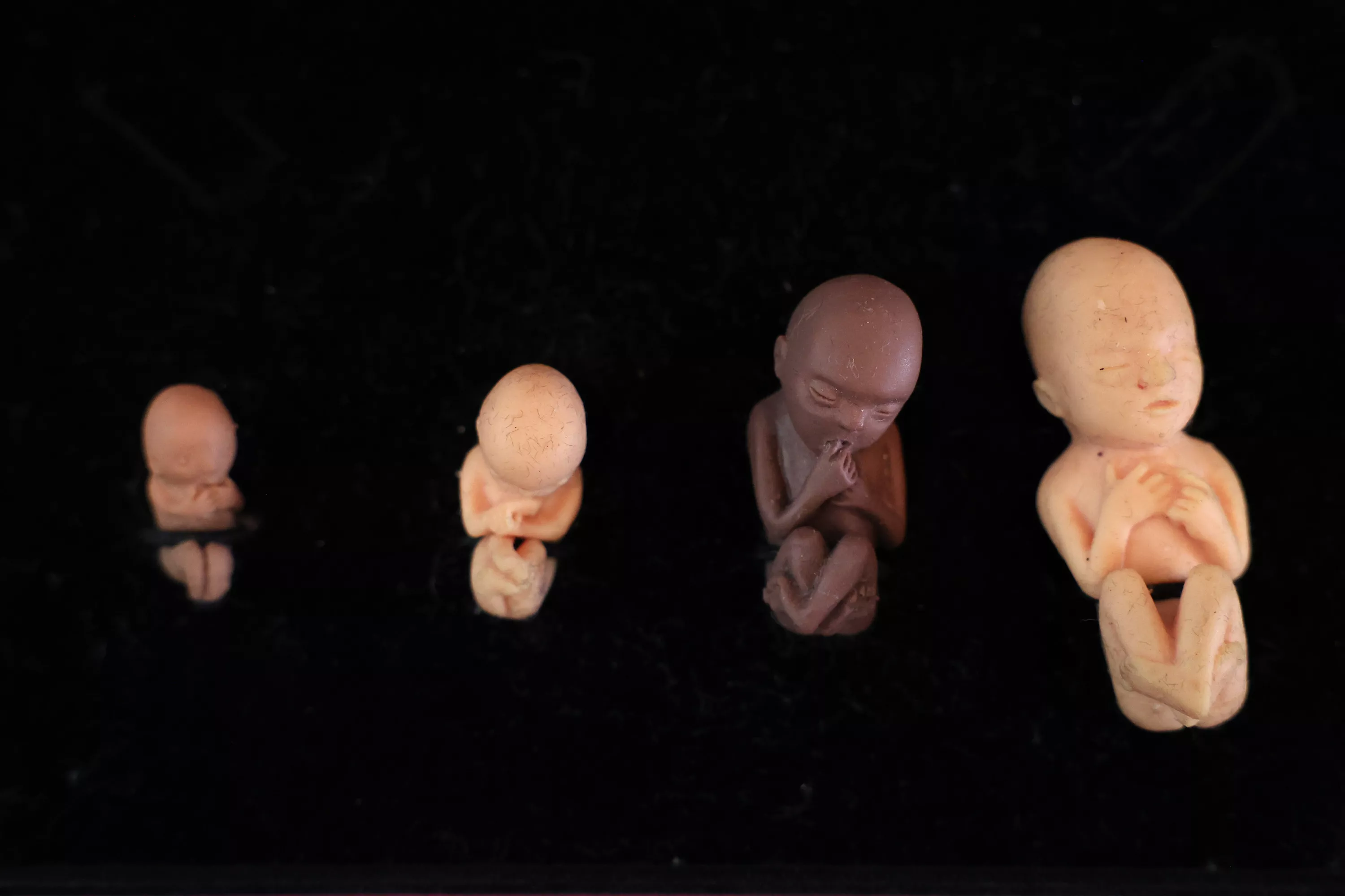 Abortion's Winning Streak Fueled by Faulty Science Standards - Vimarsana News