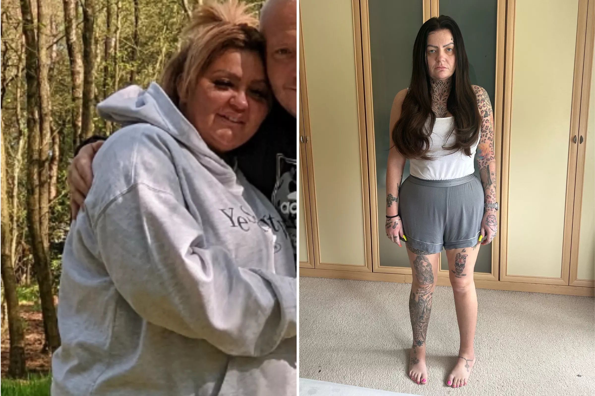 Woman's Weight-Loss Surgery Leaves Her With 8% of Her Stomach Left - Vimarsana News