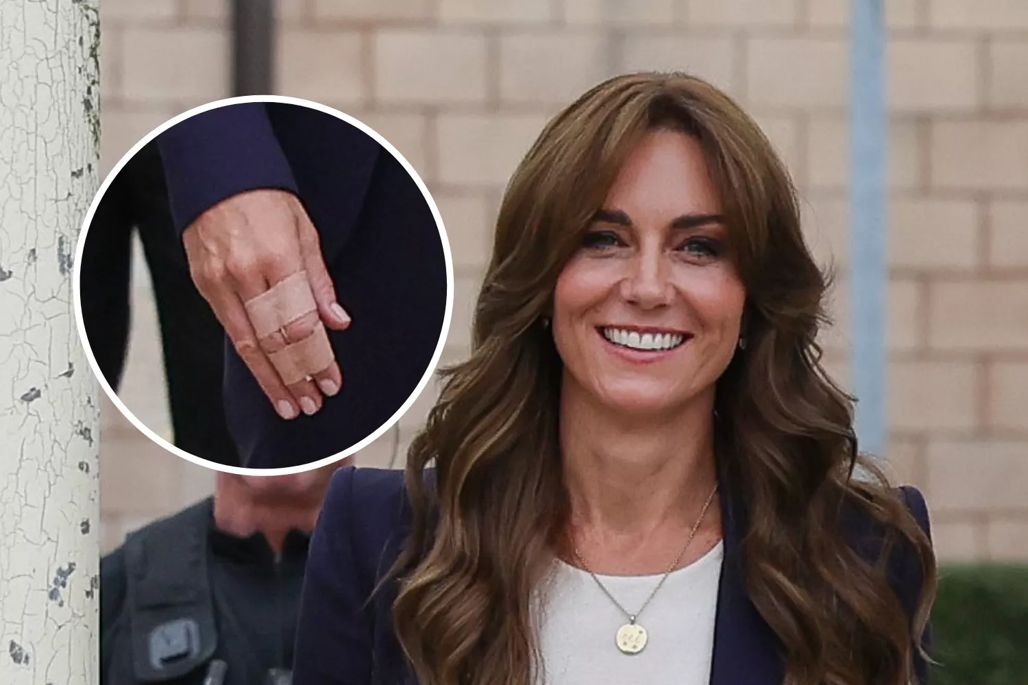 How Kate Middleton Injured Her Fingers - Vimarsana News