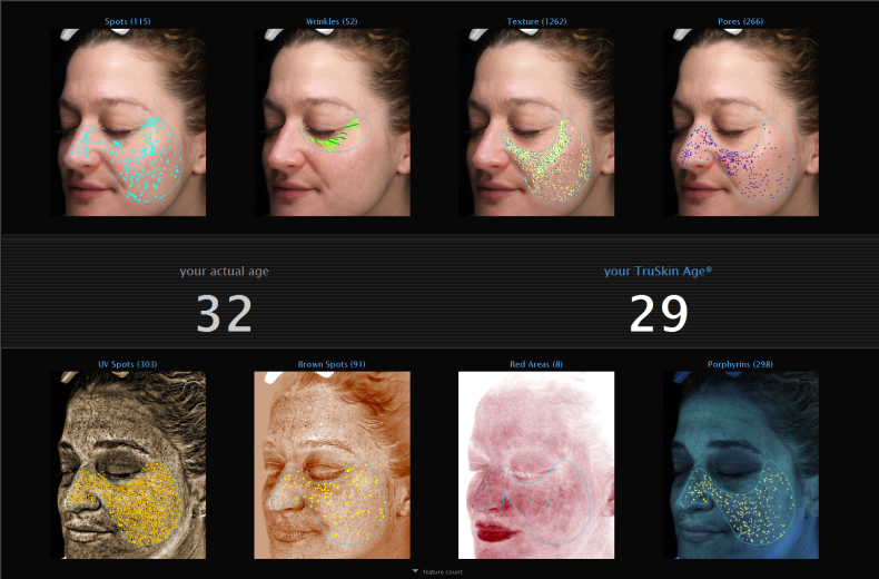 Skin analysis