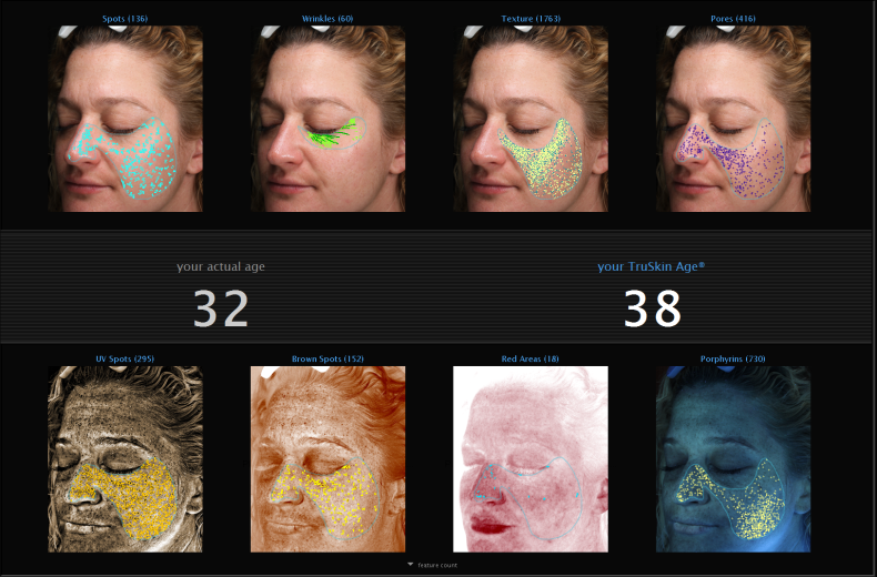 Skin analysis