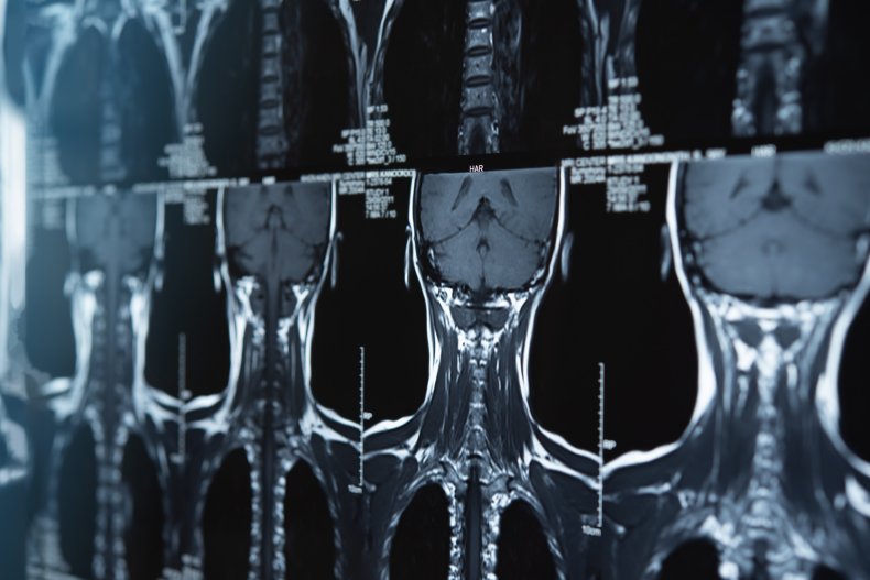 X-ray of the spine