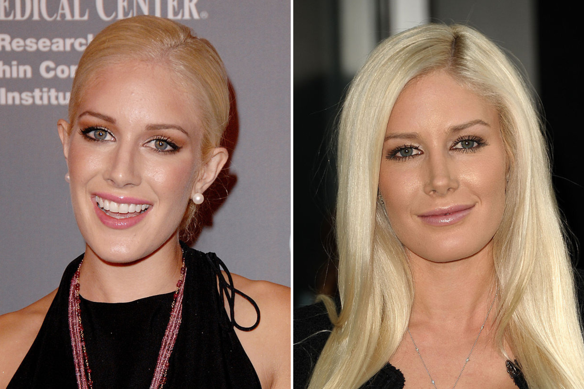 Heidi Montag in 2008 and 2011