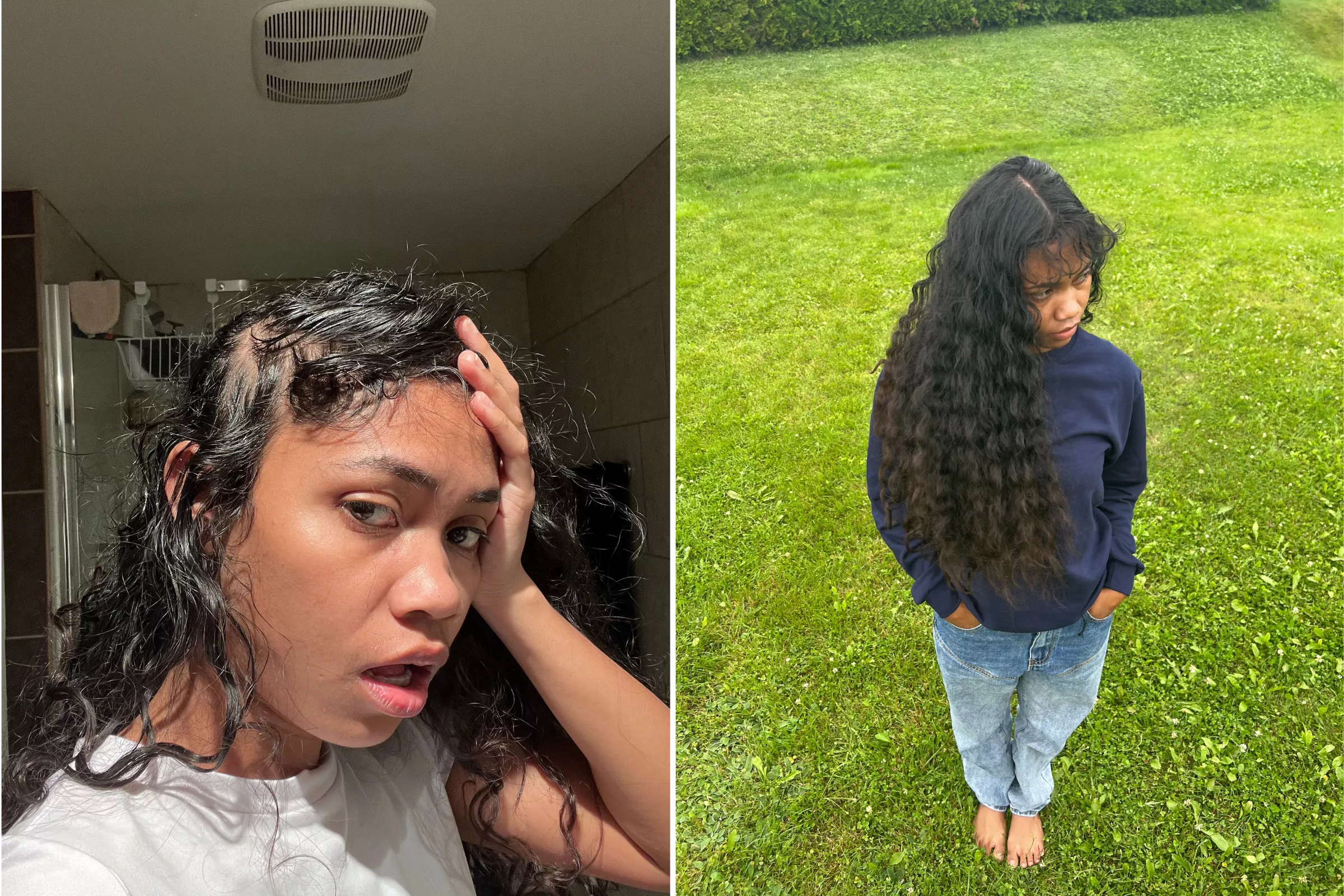Woman Shares Homemade Recipe She Claims Cured Her Distressing Hair Loss - Vimarsana News