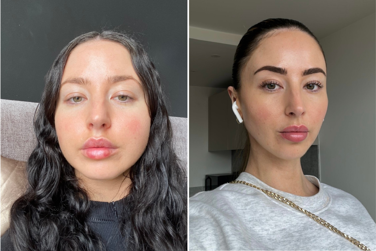 Woman Reveals How Her Face Changed After Ditching Processed Foods - Newsweek