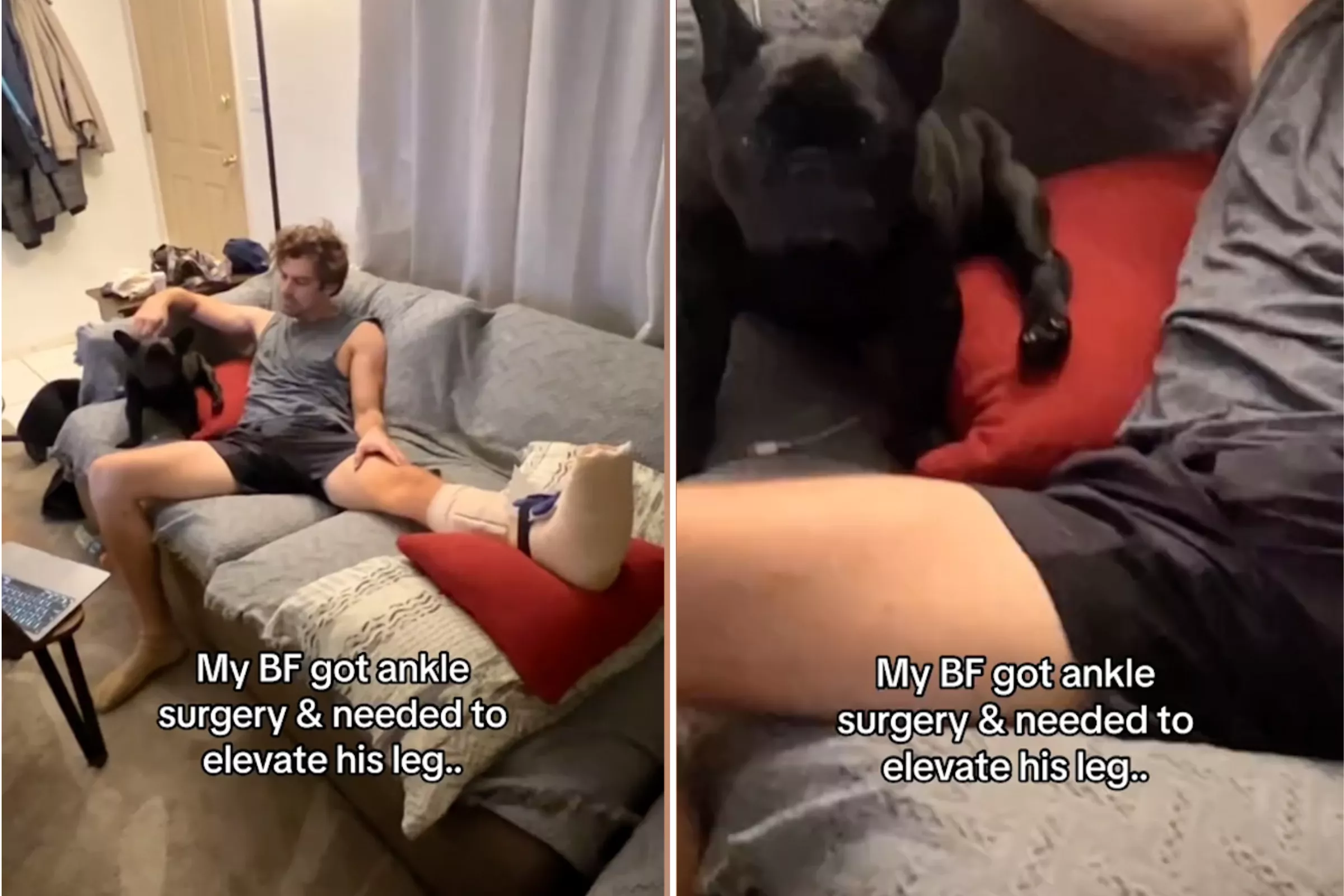 French Bulldog Adorably Copies Owner Who Injured His Leg: 'Sensed His Pain' - Vimarsana News