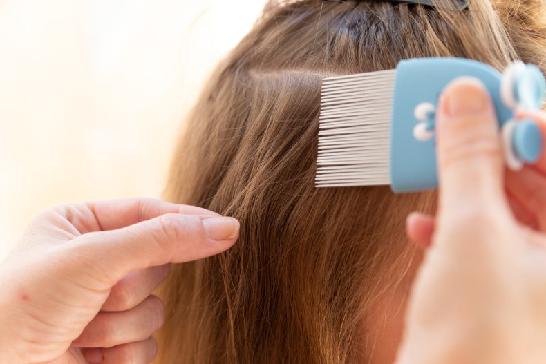Head lice removal
