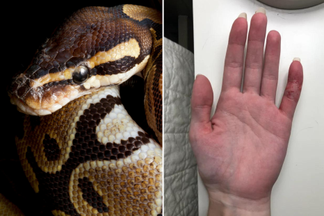 Heinous' Killing of Snakes Puts Spotlight on Florida Wildlife Officers