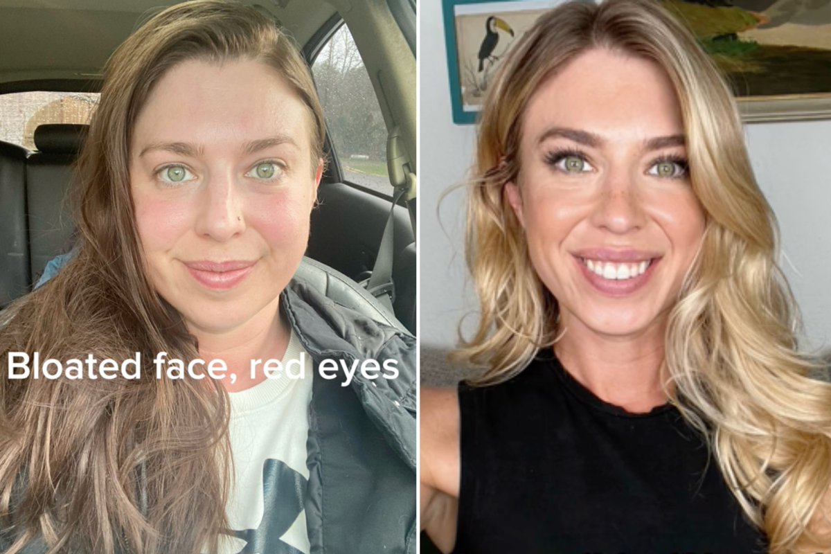 Katie before and after