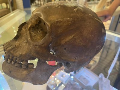 Shopper Finds Real Skull in Store 