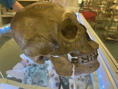 Shopper Finds Real Skull in Store Shopper Finds Real Skull in Store