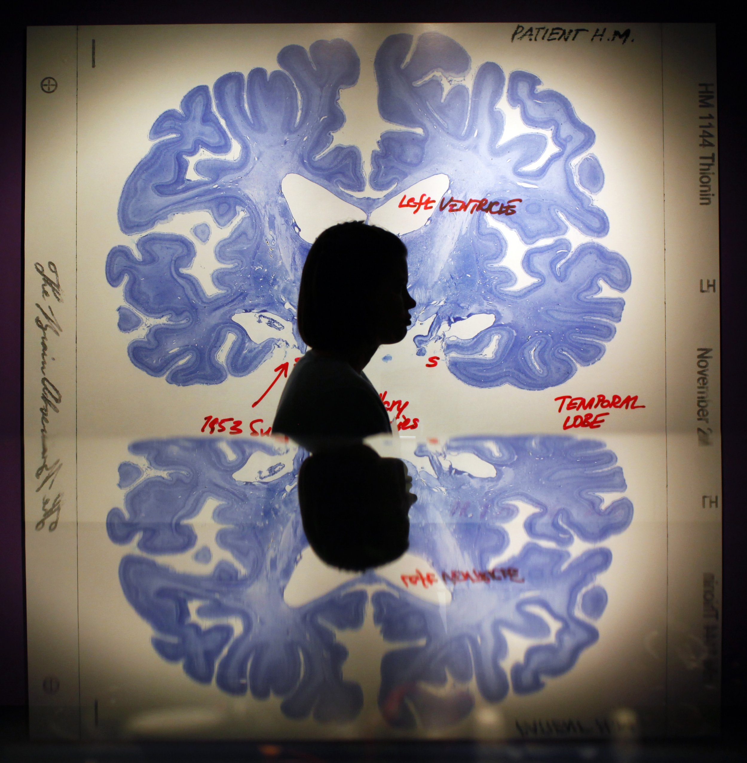 nearly-1-in-5-americans-suffers-from-mental-illness-each-year