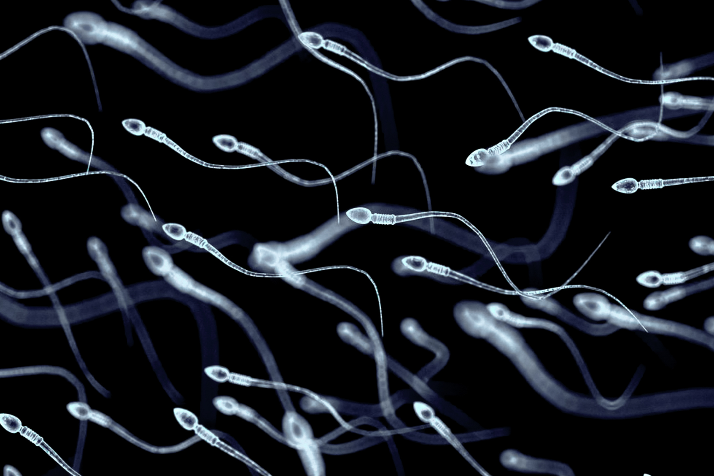 Sperm Actually Is Frazzled by Fashionable Life, Scientists Say