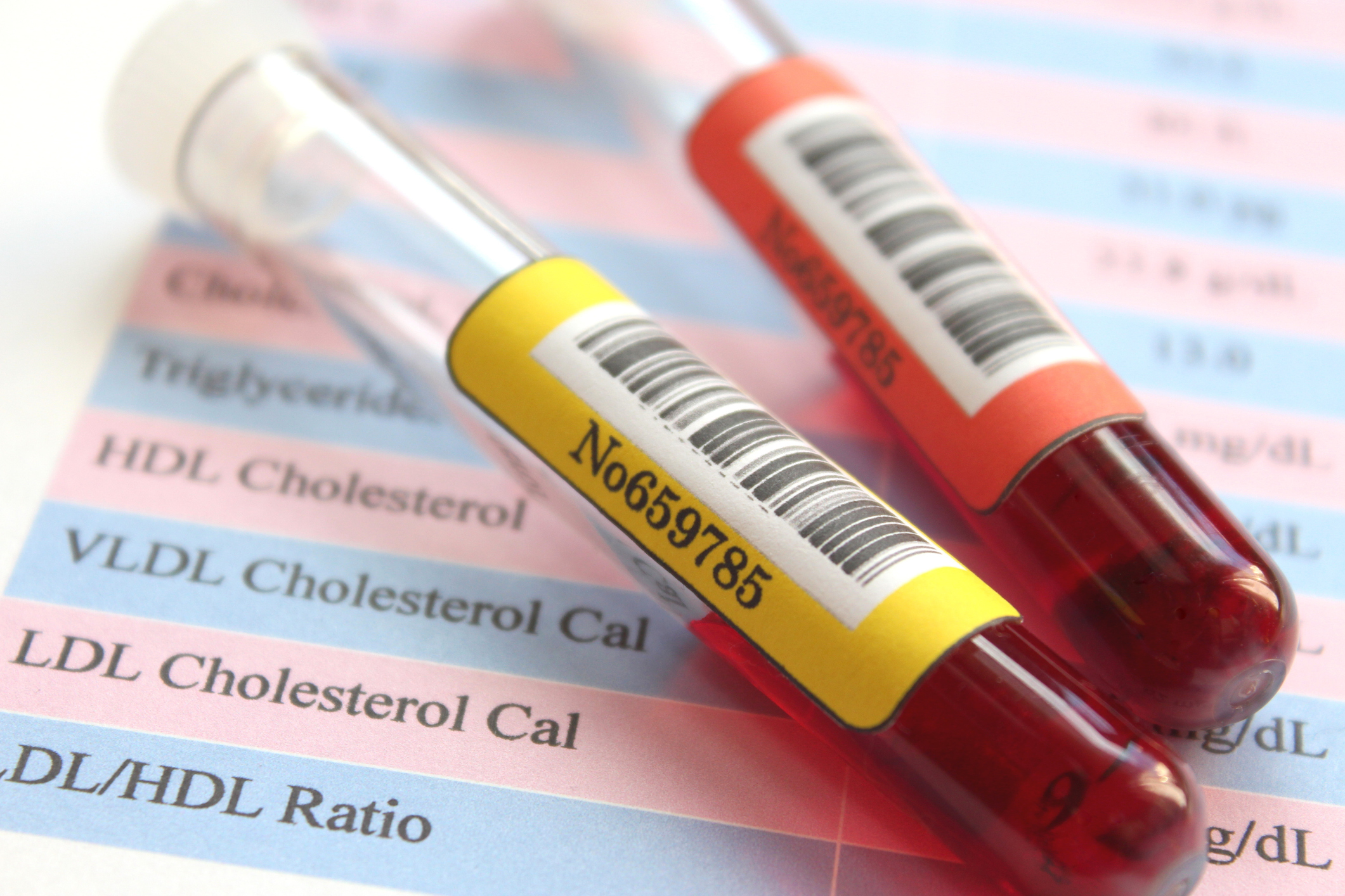 Des niveaux de bon cholestérol très élevés peuvent être liés au risque de démence, selon une étude