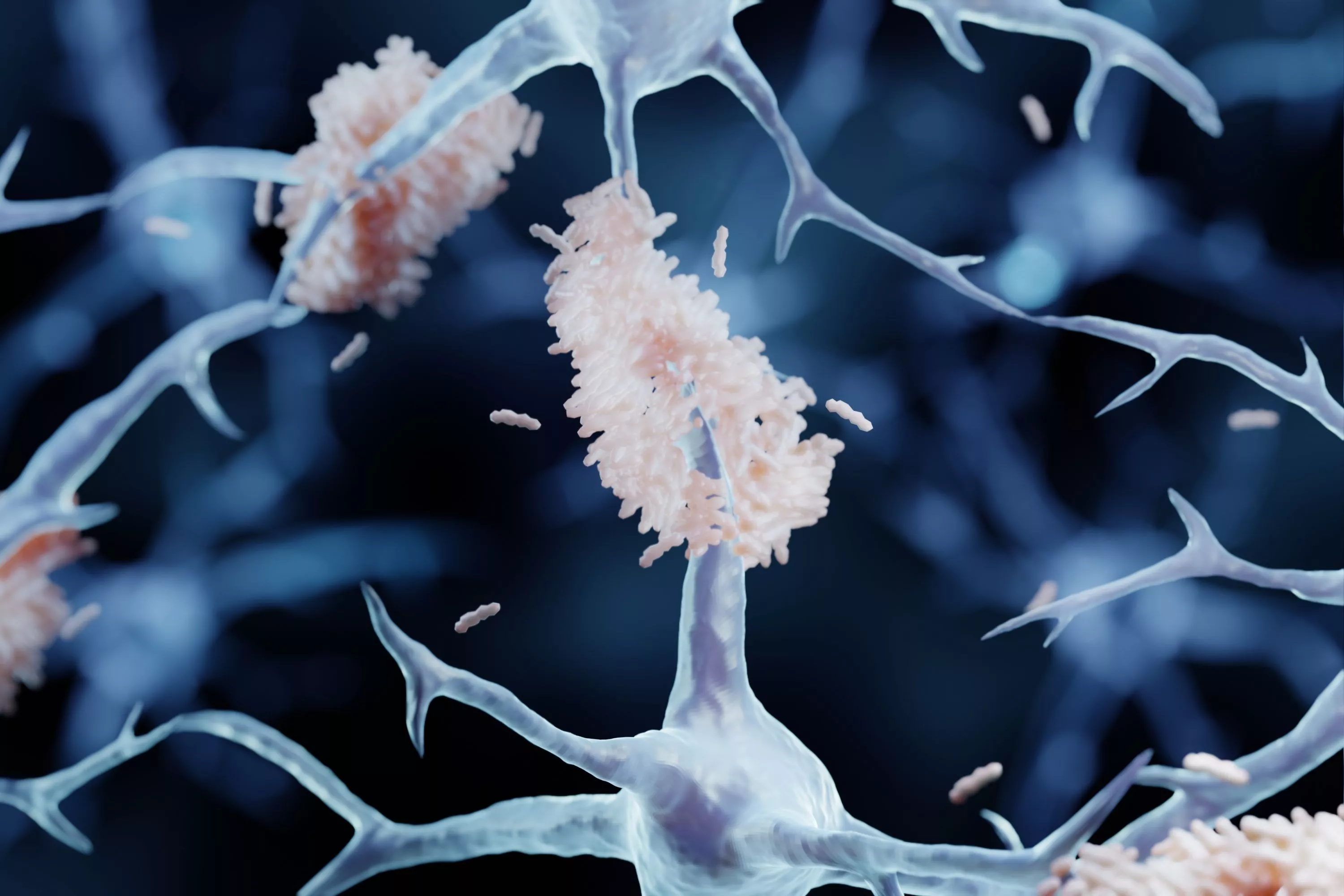 Probe Into Brain's Memory Center Could Solve Mystery of Alzheimer's Cause - Vimarsana News