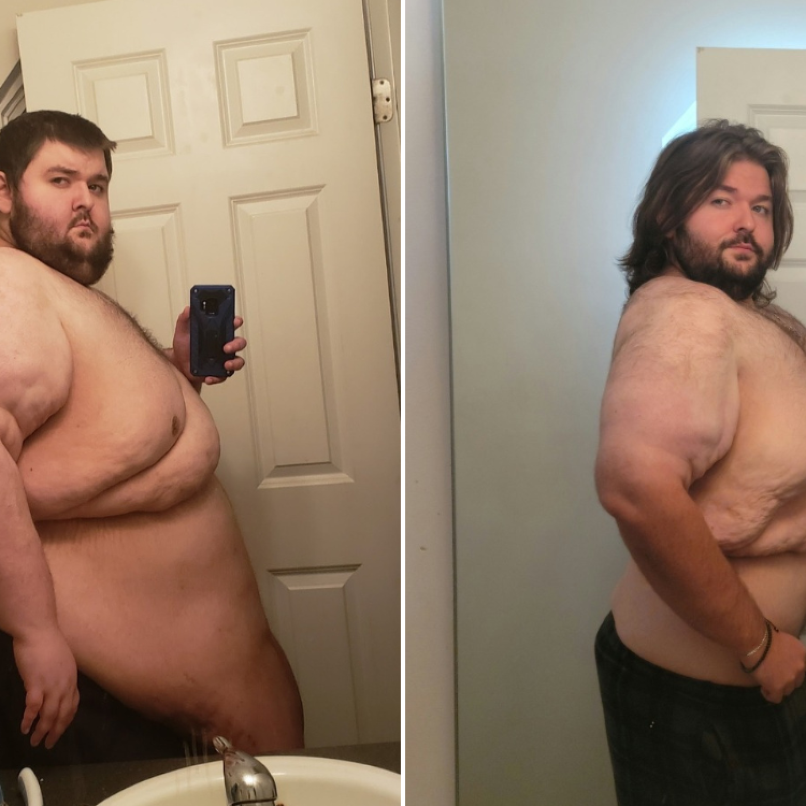 Obese Man Told He'd Be Dead Within Five Years Reveals How He Lost 400lbs