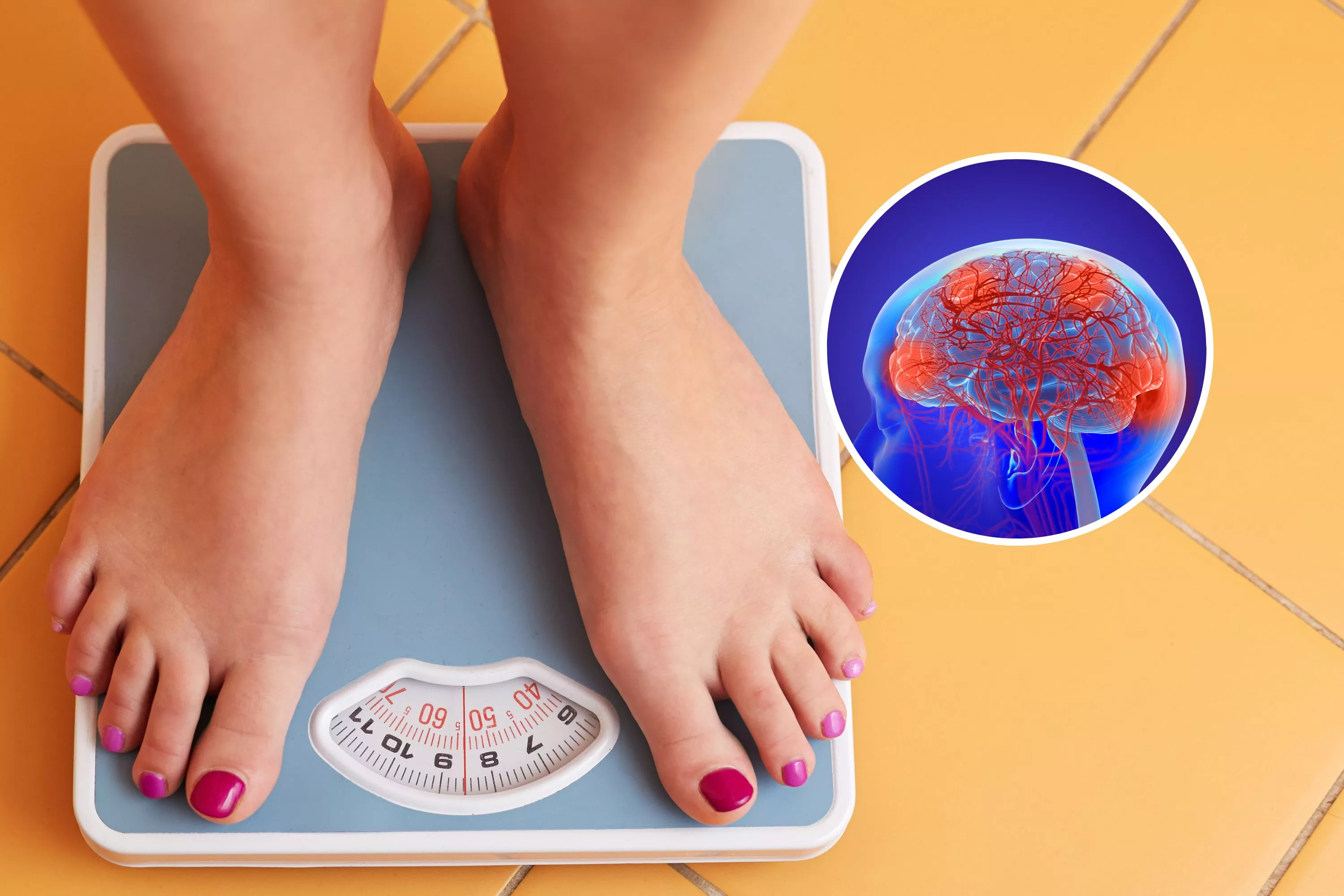 Weight Loss by Intermittent Fasting Can Alter Your Brain Activity - Vimarsana News