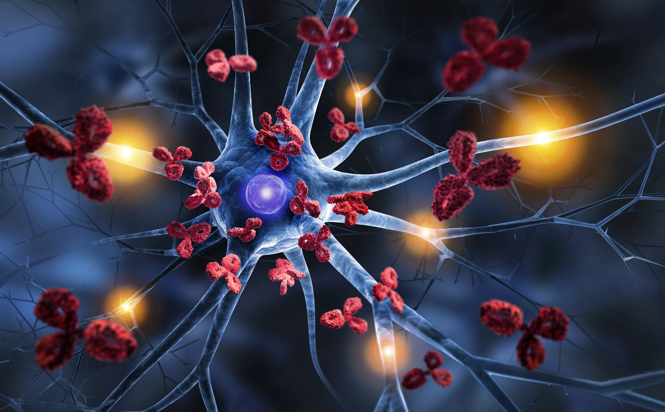 Alzheimer's Disease 'Game Changer' as Progression Slowed With Immunotherapy - Vimarsana News