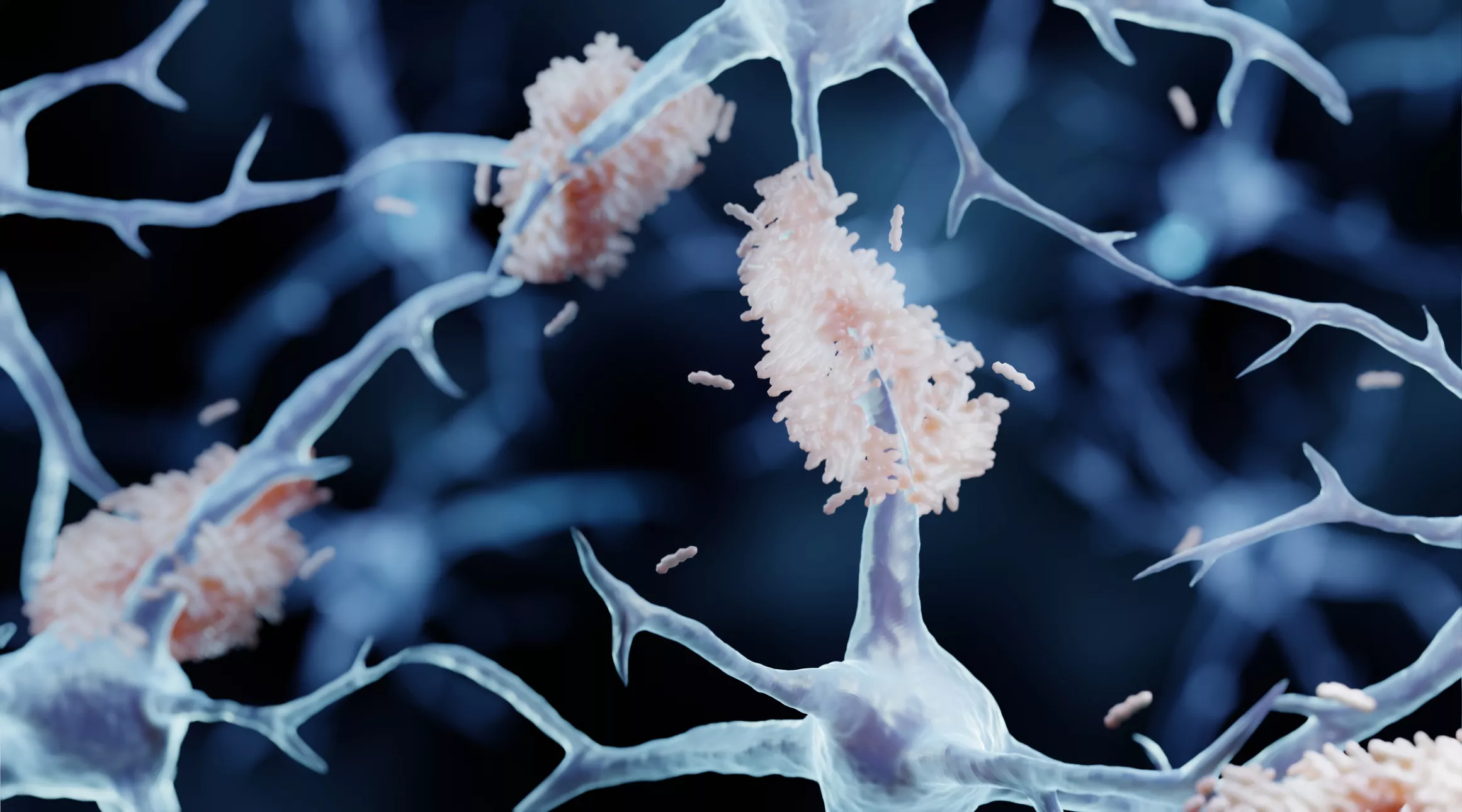 Alzheimer's Mysterious Origins May Lie in Exhausted Cells Unable to Cope - Vimarsana News