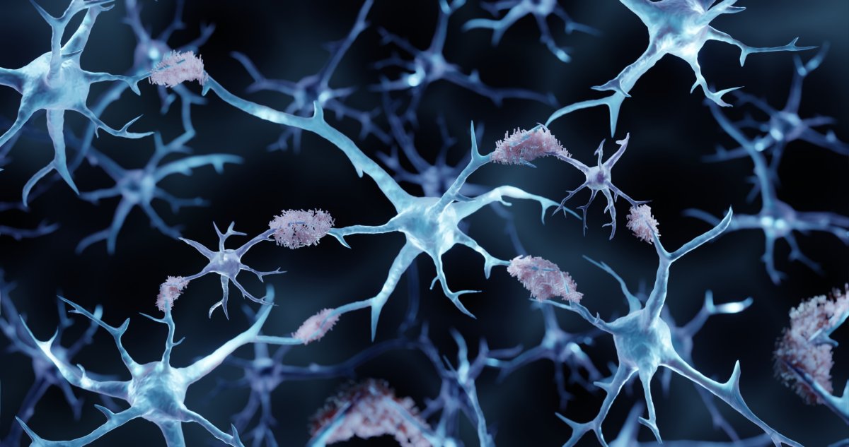 Alzheimer's brain development