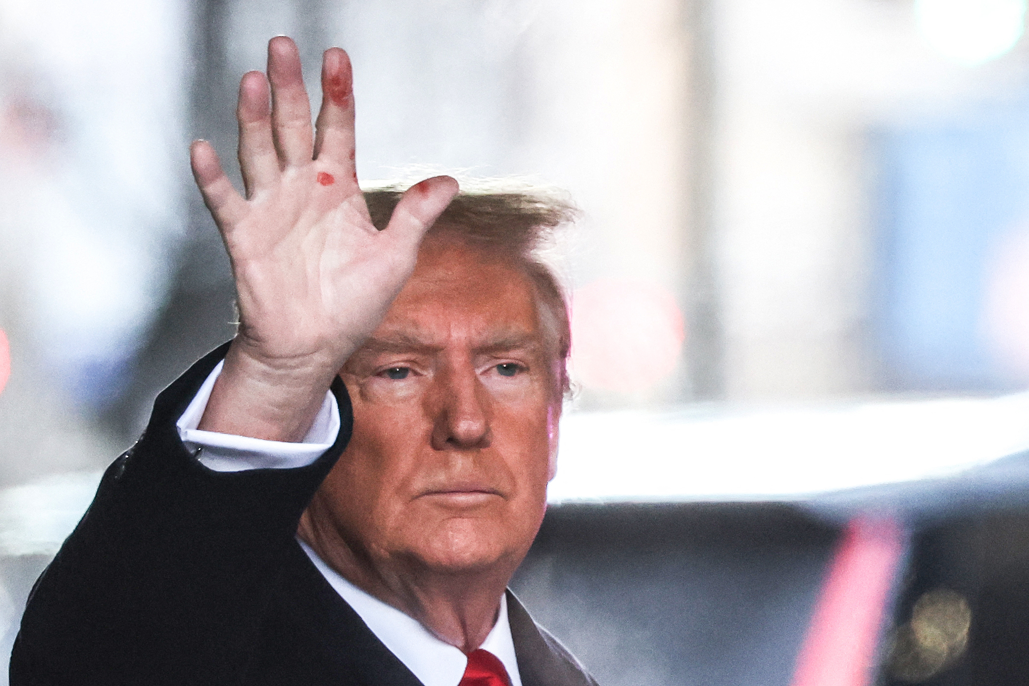 Donald Trump's Red-Spotted Hand in Photo Sparks Speculation - Newsweek