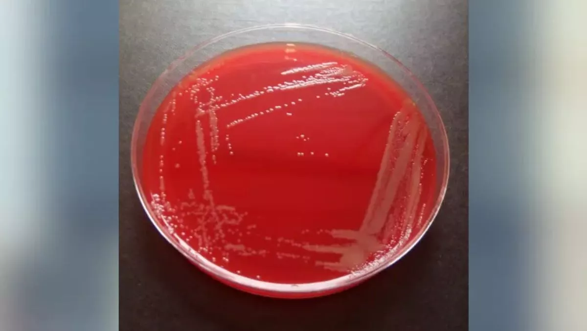 New Infectious Bacteria Species Found in Hospital Patient's Blood - Vimarsana News