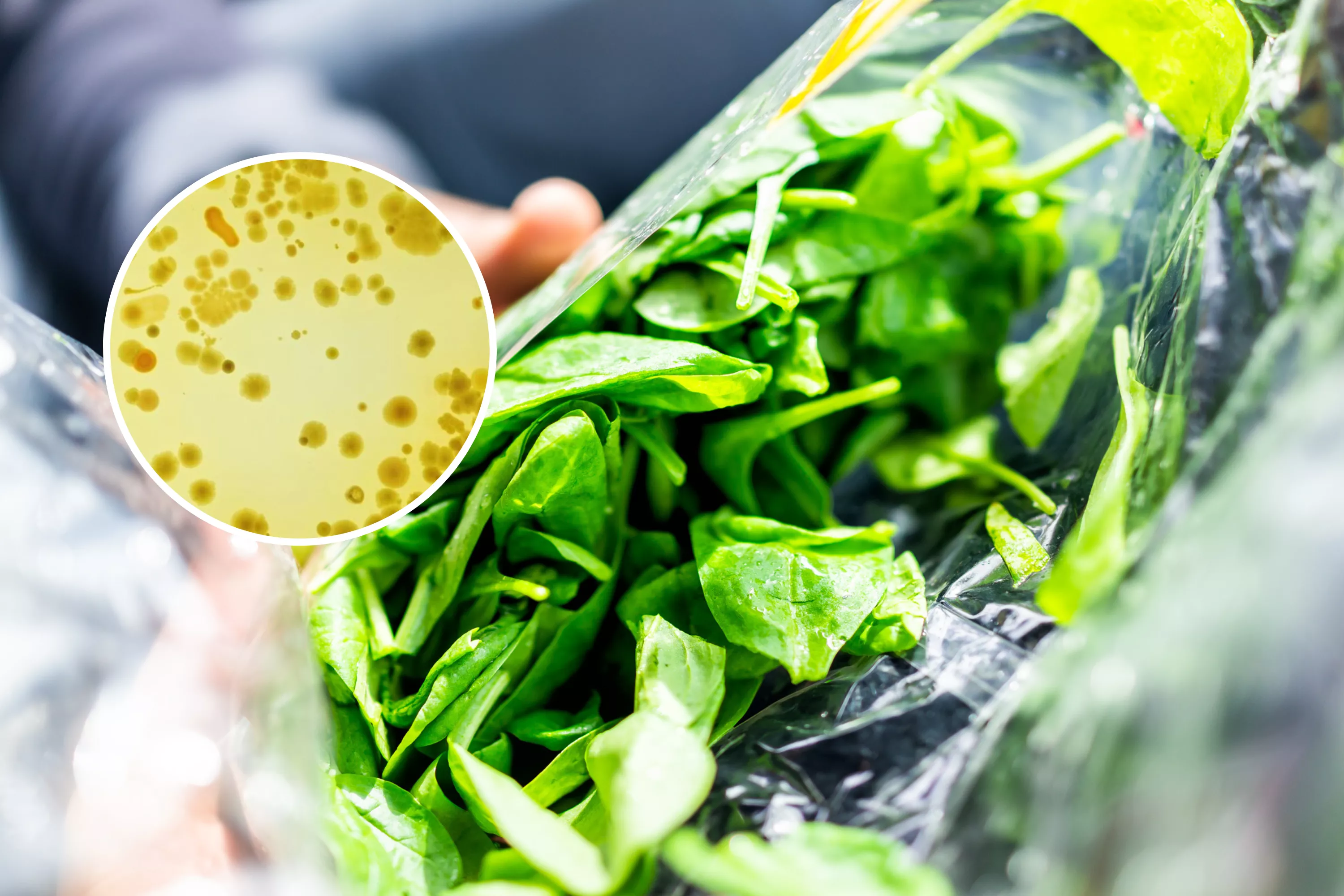 Deadly Foodborne Bacteria Found To Hide From Sanitizers - Vimarsana News