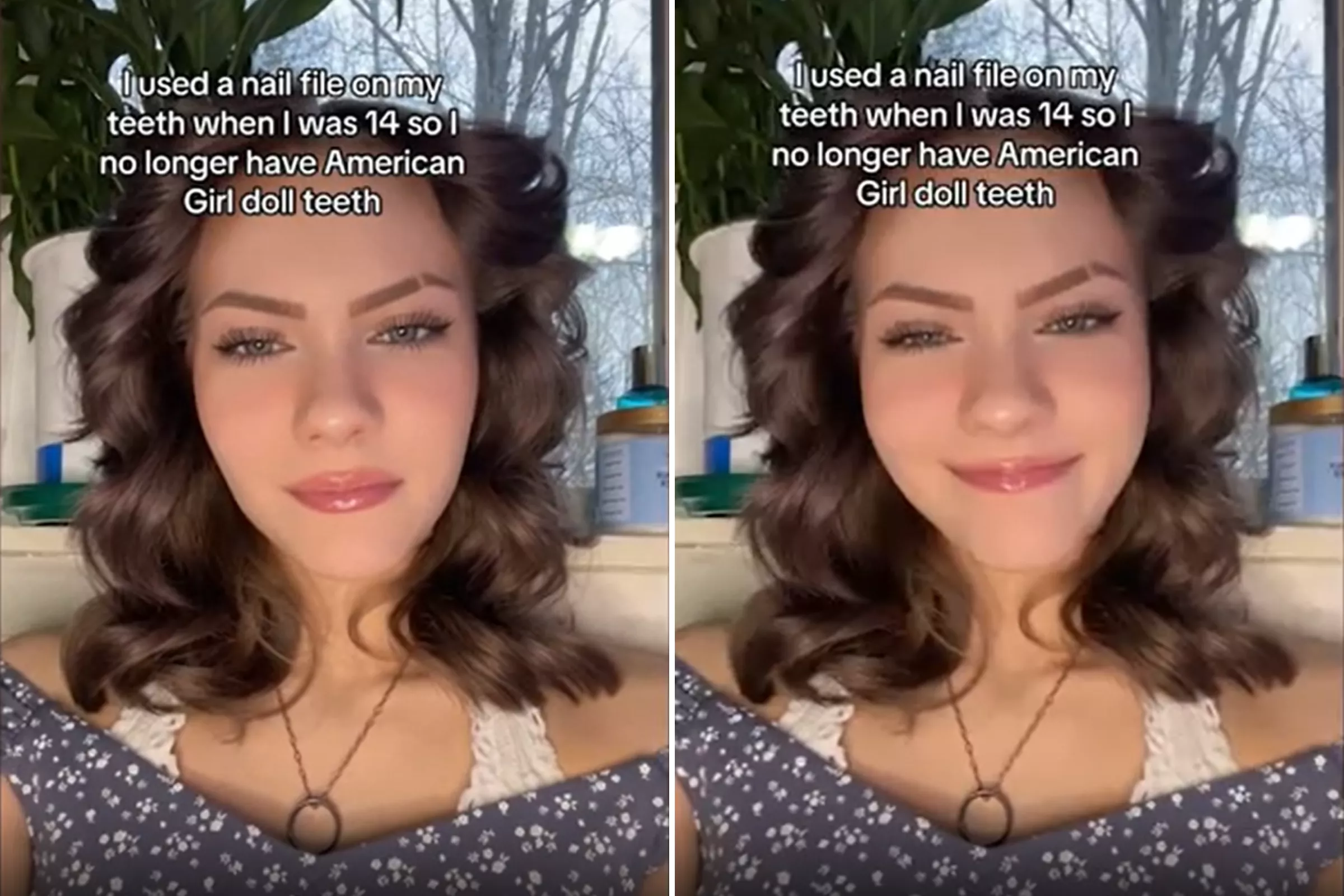 Teen Reveals Horrifying Method She Used to Avoid 'American Girl Doll Teeth' - Vimarsana News
