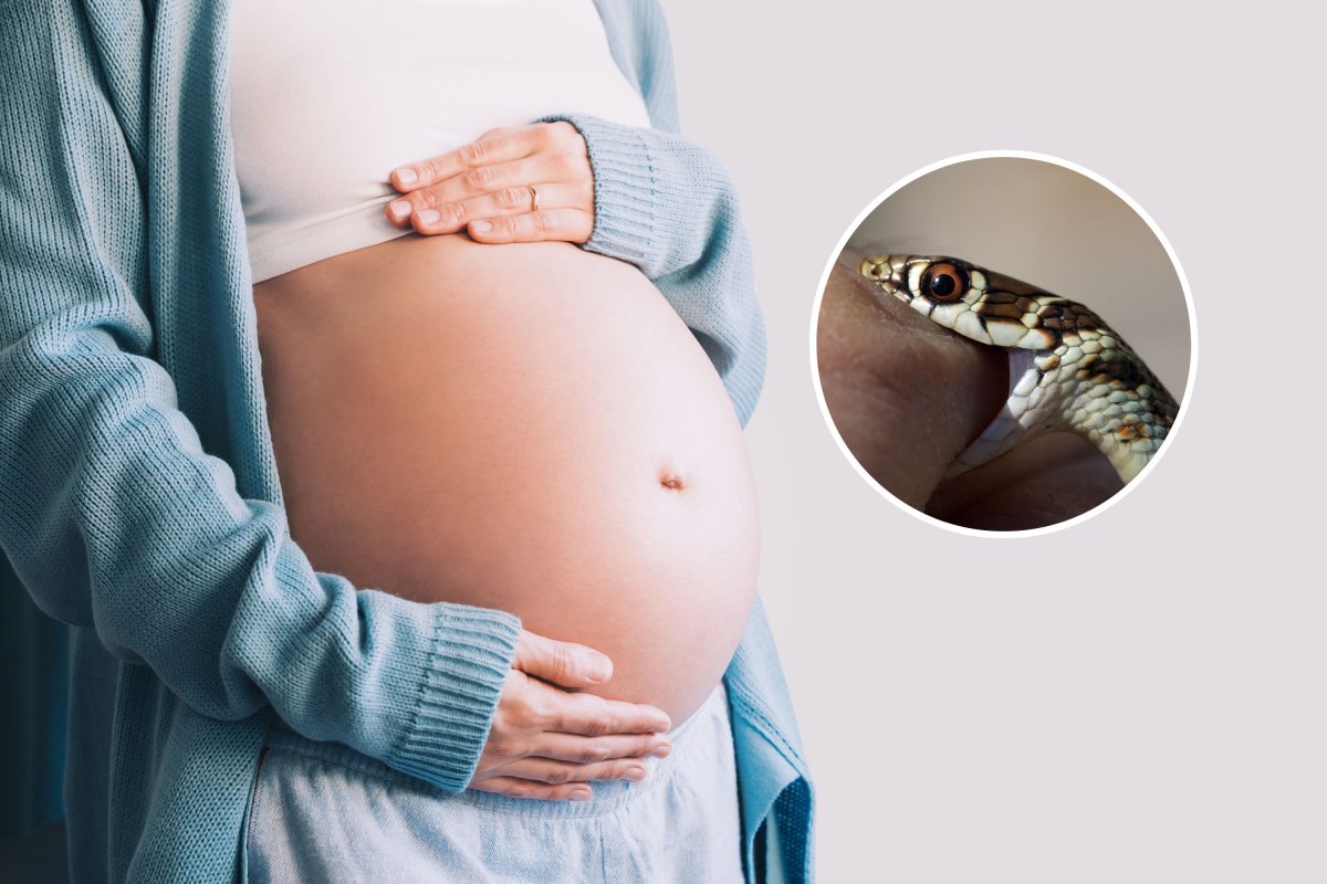 pregnant woman snakebite