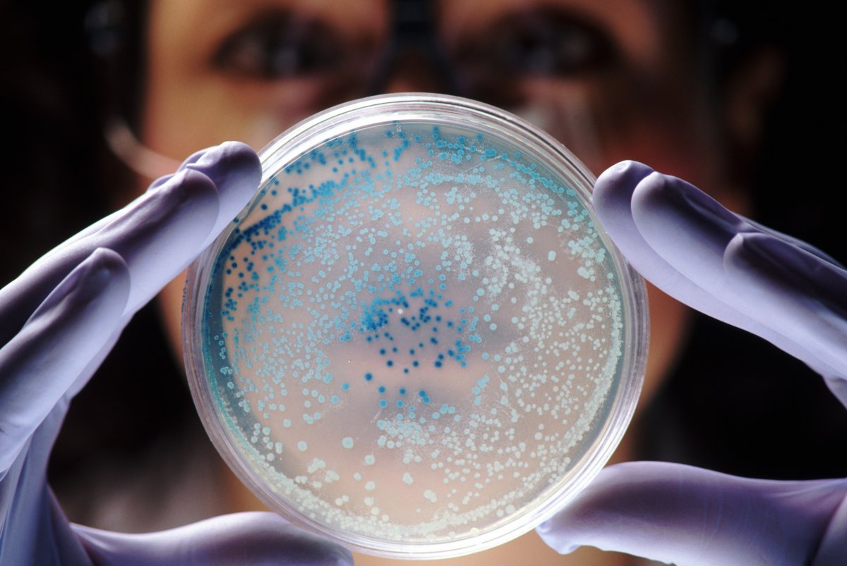 bacteria in the petri dish