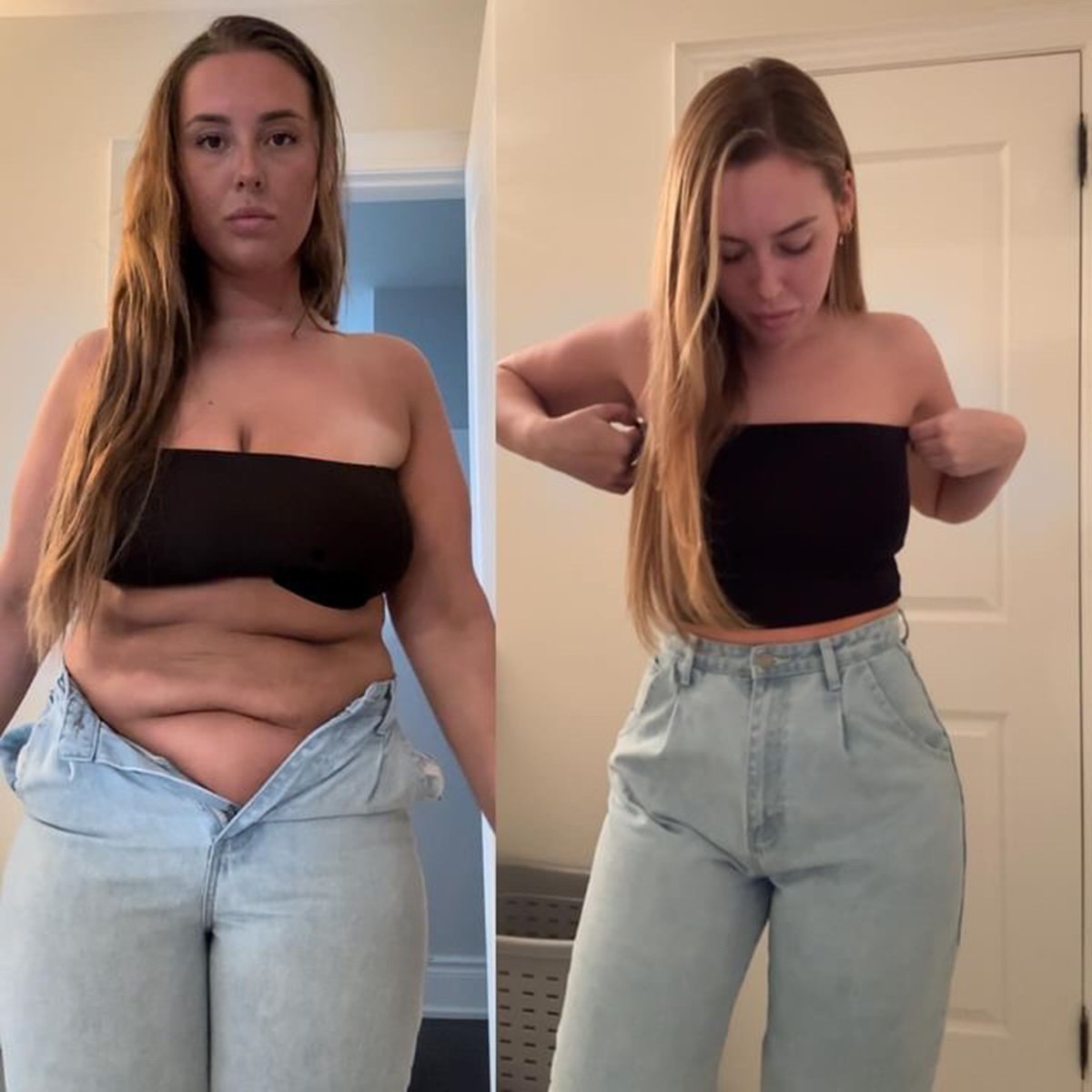 Ashley Gartley before and after