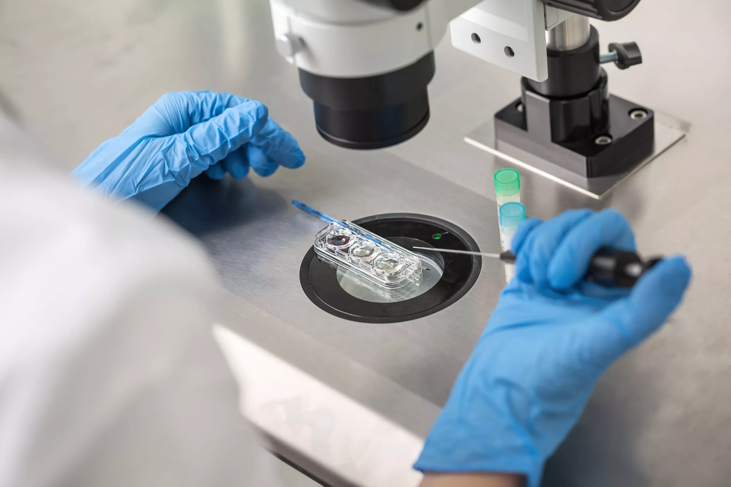 Alabama IVF Ruling: What Embryo Law Means for Treatments Going Forward - Vimarsana News