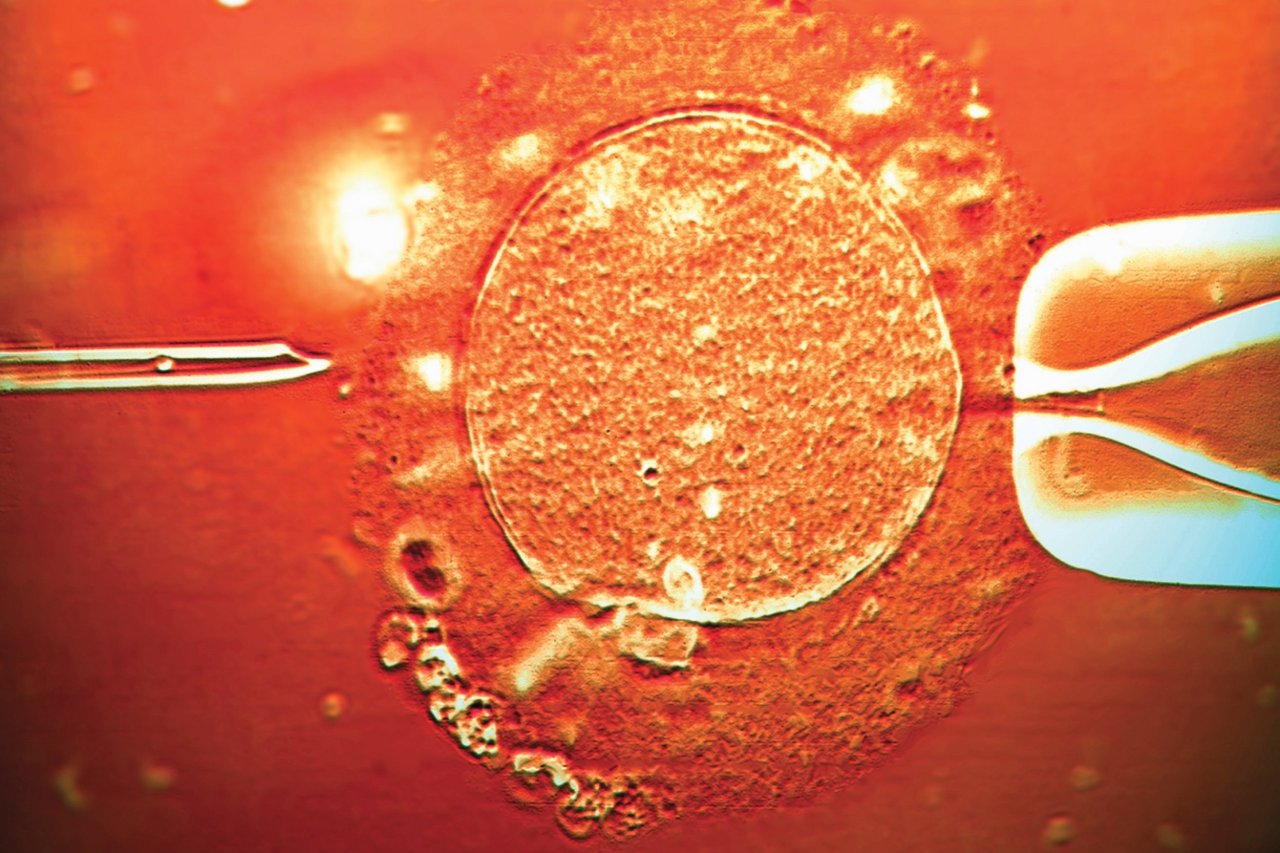 sepkowitz-nm0421-adopting-embryo-tease