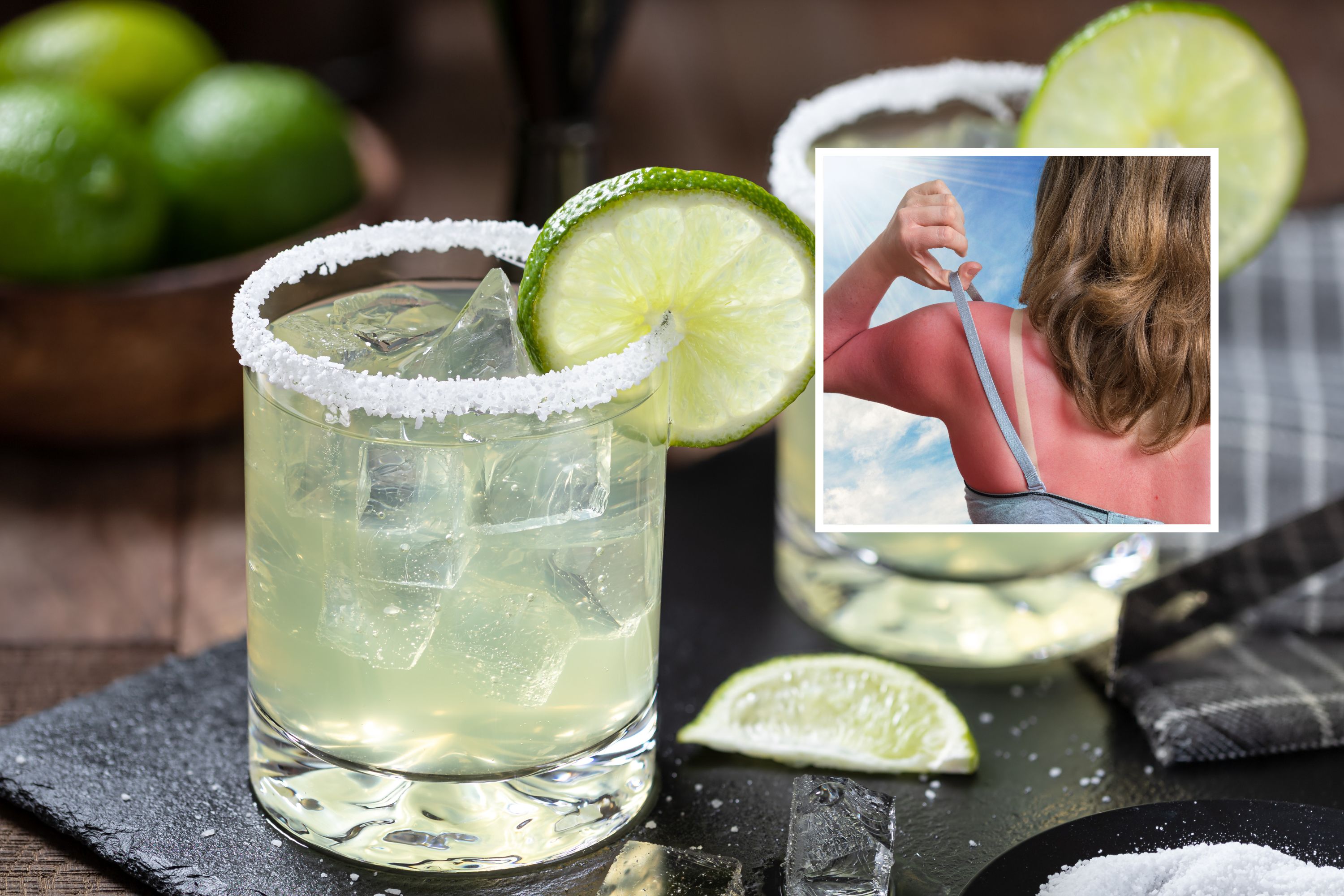 Dermatologist Reveals Why Your Margarita May Give You a RashMiddle East
